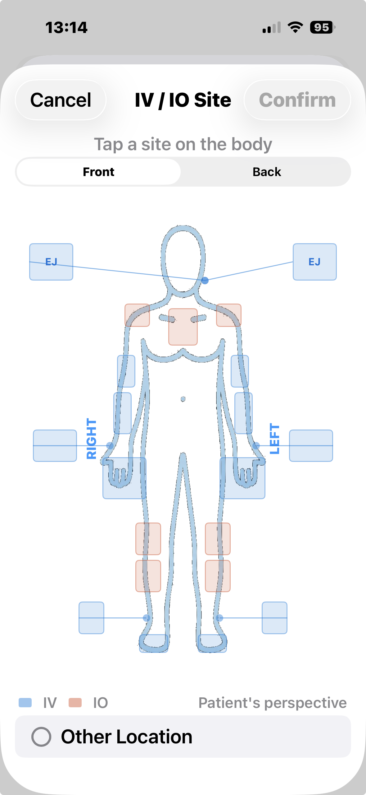 IV/IO site selector body diagram